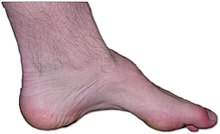 running shoes
